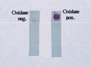 27: Oxidase Test .